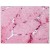 Skeletal muscle: Formalin-Fixed Paraffin-Embedded (FFPE)