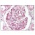 Kidney: Foramlin-Fixed Paraffin-Embedded (FFPE)