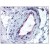 Skeletal muscle, vessel: Formalin-Fixed Paraffin-Embedded (FFPE)