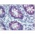 Colon: Formalin-Fixed Paraffin-Embedded (FFPE)
