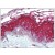 Skin: Formalin-Fixed Paraffin-Embedded (FFPE)