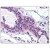 Breast: Formalin-Fixed Paraffin-Embedded (FFPE)