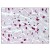 Heart: Formalin-Fixed Paraffin-Embedded (FFPE)