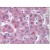 Liver: Formalin-Fixed Paraffin-Embedded (FFPE)