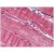 Skeletal muscle: Formalin-Fixed Paraffin-Embedded (FFPE)
