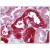 Kidney: Formalin-Fixed Paraffin-Embedded (FFPE)