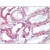 Kidney: Formalin-Fixed Paraffin-Embedded (FFPE)
