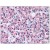AP08504PU-N PTH antibody staining of Formalin-Fixed Paraffin-Embedded Human Parathyroid at 5 µg/ml followed by biotinylated anti-goat IgG secondary antibody, alkaline phosphatase-streptavidin and chromogen.