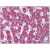 Liver: Formalin-Fixed Paraffin-Embedded (FFPE)