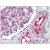 Kidney: Formalin-Fixed Paraffin-Embedded (FFPE)