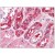 Kidney: Fromalin-Fixed Paraffin-Embedded (FFPE)