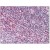 Tonsil: Formalin-Fixed Paraffin-Embedded (FFPE)