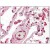 Lung: Formalin-Fixed Paraffin-Embedded (FFPE)