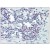 Formalin-Fixed, Paraffin-Embedded Human Colon, lymphocytes PLCG1 antibody Cat.-No AP08580PU-N at 1/25-1/100 followed by biotinylated Goat anti-Rabbit IgG secondary antibody, alkaline phosphatase-streptavidin and chromogen.