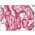 Placenta: Formalin-Fixed Paraffin-Embedded (FFPE)