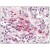 Spleen, macrophages: Formalin-Fixed Paraffin-Embedded (FFPE)