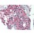 Formalin-Fixed Paraffin-Embedded Human Testis stained with ALDH1A1 antibody Cat.-No AP08840PU-N  at 2.5 µg/ml followed by biotinylated anti-goat IgG secondary antibody, alkaline phosphatase-streptavidin and chromogen.