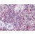 Spleen: Formalin-Fixed, Paraffin-Embedded (FFPE)