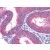 Uterus: Formalin-Fixed Paraffin Embedded (FFPE)
