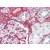 Human Kidney (formalin-fixed, paraffin-embedded) stained with COL5A1 antibody AP09015BT-N at 1.25 µg/ml followed by biotinylated goat anti-rabbit IgG secondary antibody, alkaline phosphatase-streptavidin and chromogen.