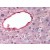 Liver: Formalin-Fixed Paraffin-Embedded (FFPE)