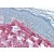 Skin: Formalin-Fixed Paraffin-Embedded (FFPE) using Collagen I antibody.