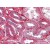 Kidney: Formalin-Fixed Paraffin-Embedded (FFPE)