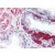 Prostate: Formalin-Fixed, Paraffin-Embedded (FFPE)