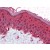 Skin: Formalin-Fixed, Paraffin-Embedded (FFPE)