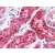 Kidney: Formalin-Fixed, Paraffin-Embedded (FFPE)