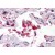 Formalin-Fixed, Paraffin-Embedded Human Lung staining using AP08912PU-N AIF1 Antibody at 5 µg/ml after heat-induced antigen retrieval.
