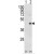 Western blot analysis of CEBPB (arrow) using rabbit polyclonal CEBPB Antibody (C-term) (AP17939PU-N). 293 cell lysates (2 ug/lane) either nontransfected (Lane 1) or transiently transfected with the CEBPB gene (Lane 2) .