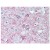 AM12133PU-N ADORA2A antibody staining of Formalin-Fixed Paraffin-Embedded Human Brain, Putamen at 5 µg/ml after heat-induced antigen retrieval.