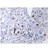 Immunohistochemistry (IHC) analyzes of HP1-alpha antibody (Cat.-No.: AP06694PU-N) in paraffin-embedded human liver carcinoma tissue.