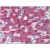 Immunohistochemistry: AM20110PU-N Factor H antibody staining of Formalin-Fixed, Paraffin-Embedded Human Liver followed by biotinylated secondary antibody, alkaline phosphatase-streptavidin and chromogen.