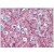 Immunohistochemistry : BM017 BMP antibody staining of Formalin-Fixed Paraffin-Embedded Human Brain, Cortex at 10 ug/ml followed by biotinylated anti-mouse IgG secondary antibody, alkaline phosphatase-streptavidin and chromogen.
