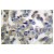 Immunohistochemistry Analysis: AP20201PU-N Synaptotagmin antibody staining of Paraffin-Embedded Human breast carcinoma tissue.