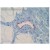 LYVE-1 antibody staining of Human Intestine (border area of a Colon Carcinoma).
The experiment has been performed by Dr. Karsten Debel, DCS, Hamburg, Germany.