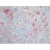 BM4032 CD11b antibody staining of Human Tonsil Frozen Section.