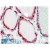 AP22449PU-N FZD2 antibody
staining of paraffin embedded Human Thyroid Gland at 2.5 µg/ml. Steamed antigen retrieval with citrate buffer pH 6, AP-staining.