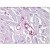 Human Heart, capillaries: Formalin-Fixed, Paraffin-Embedded (FFPE)