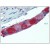 Small intestine, submucosal plexus, Human: Formalin-Fixed, Paraffin-Embedded (FFPE)