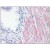 Human Prostate: Formalin-Fixed, Paraffin-Embedded (FFPE)