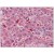Liver, Human: Formalin-Fixed, Paraffin-Embedded (FFPE)