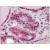 Thyroid, Human: Formalin-Fixed, Paraffin-Embedded (FFPE)
