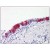Human Lung, respiratory epithelium: Formalin-Fixed, Paraffin-Embedded (FFPE)