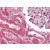 Human Kidney (formalin-fixed, paraffin-embedded) stained with Collagen I antibody AP22813AF-N followed by biotinylated goat anti-rabbit IgG secondary antibody, alkaline phosphatase-streptavidin and chromogen.