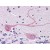 Human Brain, Cerebellum (formalin-fixed, paraffin-embedded) stained with ARMET antibody AP22598PU-N at 5 µg/ml followed by biotinylated goat anti-rabbit IgG secondary antibody, alkaline phosphatase-streptavidin and chromogen.