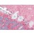 Human Brain, Cerebellum (formalin-fixed, paraffin-embedded) stained with SLITRK2 antibody AP22670PU-N at 5 µg/ml followed by biotinylated goat anti-rabbit IgG secondary antibody, alkaline phosphatase-streptavidin and chromogen.