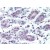 Human Breast (formalin-fixed, paraffin-embedded) stained with ABCB5 antibody AP22781PU-N followed by biotinylated goat anti-rabbit IgG secondary antibody, alkaline phosphatase-streptavidin and chromogen.